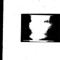 B0374-01908